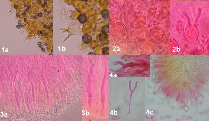 types of basidia- see text for details