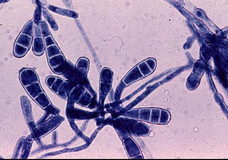 Epidermophyton floccosum macroconidia