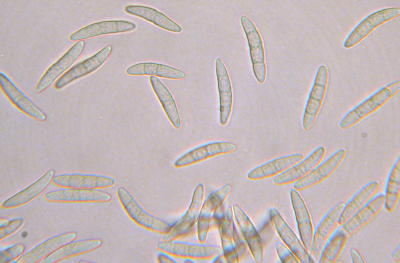 ascospores of Gibberella zeae removed from the asci