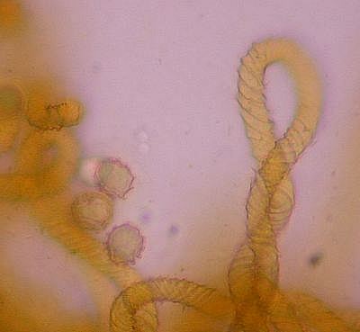 Hemitrichia serpula capillitium and spores