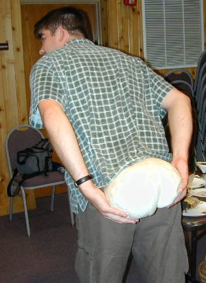 Jerry Weiland's new butt