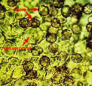 Russulales spores and sphaerocysts