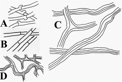 hyphal system of fungi A= generative hyphae with clamps, B= generative hyphae with simple septa, C= skeletal hyphae D= binding hyphae