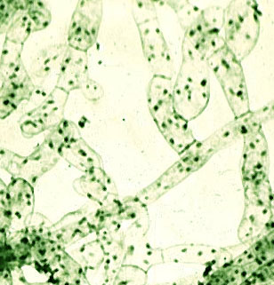 Profollias hyphae no stain, showing chloroplasts