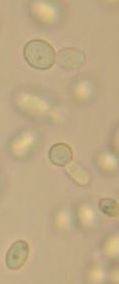 budding yeast cells