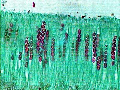 Scutellinia scutellata fruiting body cross section