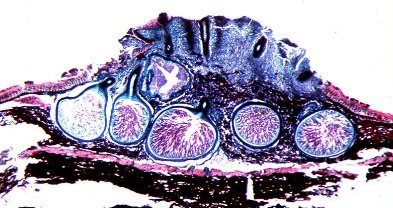 microscopic view of stroma of Cryphonectria