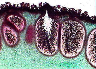 Xylaria polymorpha fruiting bodies cross section micro